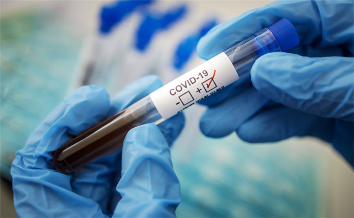 Как сдать анализы на коронавирус? Все доступные способы