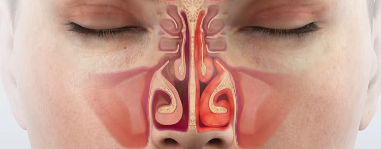 Першение в горле: причины и методы лечения